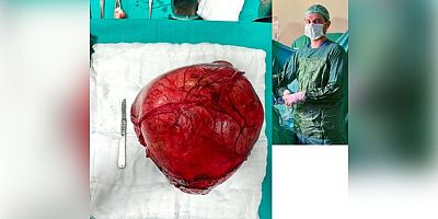 AKŞEHİR DEVLET HASTANESİ’NDE BAŞARILI VE NADİR BİR AMELİYAT